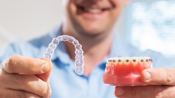 Invisible Aligners: An Alternative to Metal Braces? | invisible aligners as alternative to metal braces