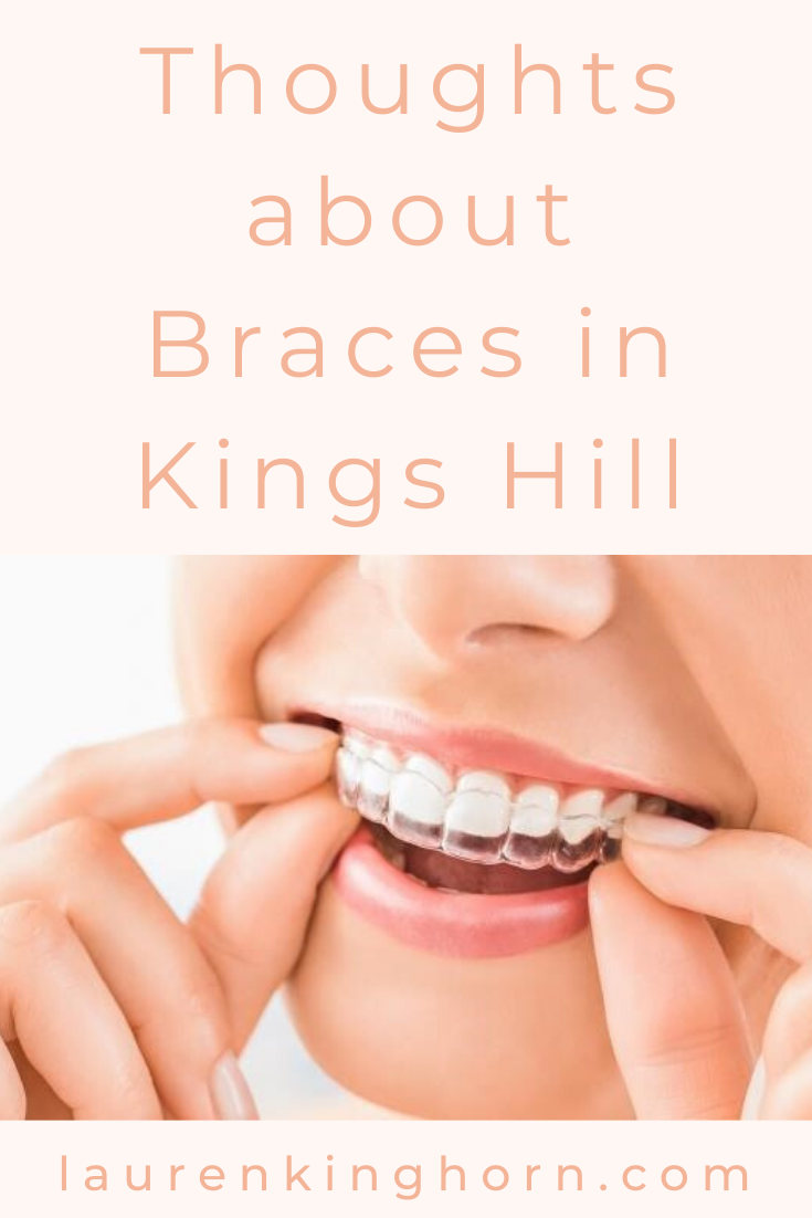 Thoughts about Braces in Kings Hill